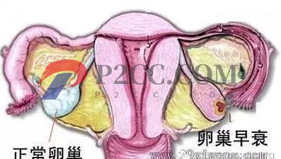 女人做了试管婴儿人就废了？好可怕，真的吗？(图2)