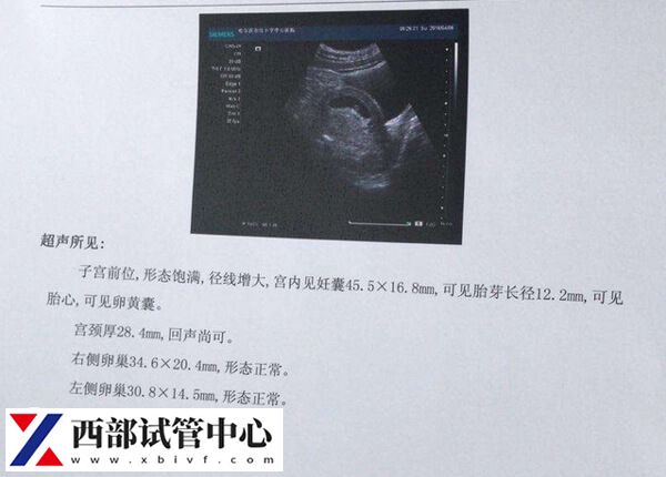 监测卵泡破裂：彩超和阴超1分钟讲清！