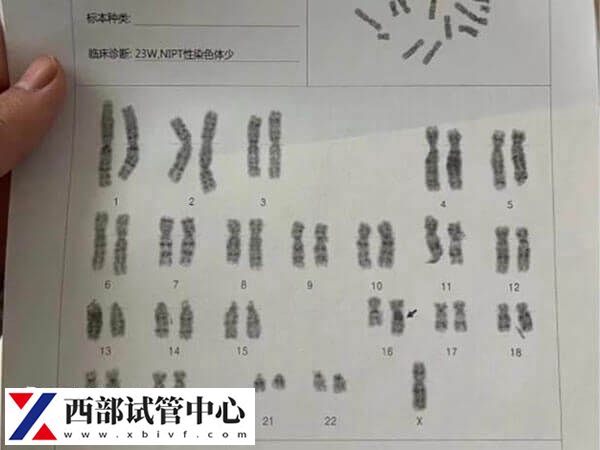 二代试管不可以避免染色体异常