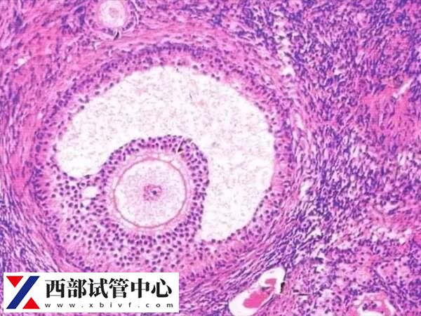 促排卵期间需要做b超检查