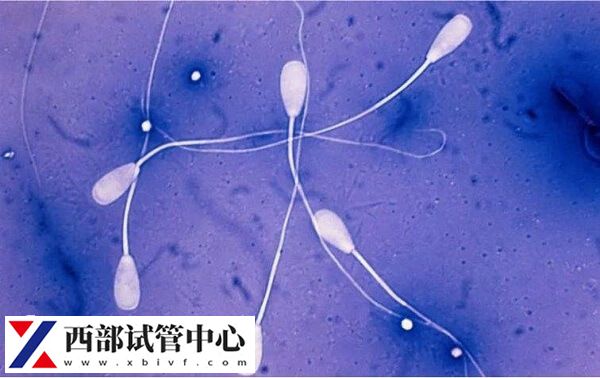 在四川省人民医院做精子碎片检查的价格是多少？