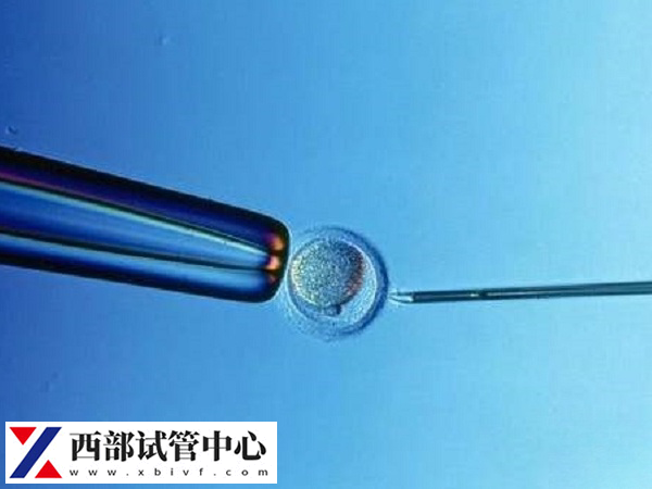 在重庆做试管婴儿成功率有多少(图2) 重庆试管婴儿成功率有50%
