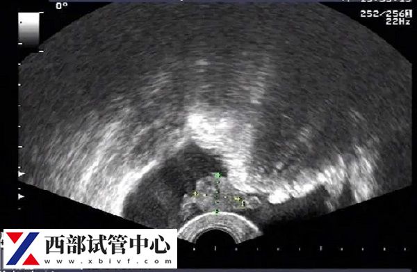 卵黄囊最迟什么时候有