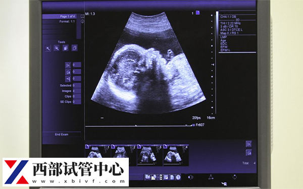 女性fsh10.8做试管的成功率是多少