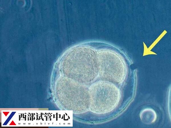 胚胎冷冻技术是辅助生殖技术的衍生技术