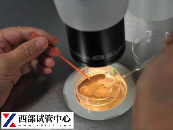 试管移植后48小时如何提高成功率(图2) 试管移植又称体外受精-胚胎移植