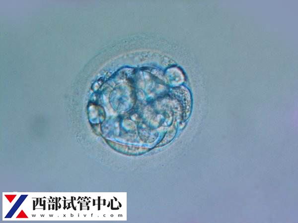 试管移植13天水印正不正常看这，或与胚胎着床有关别不知