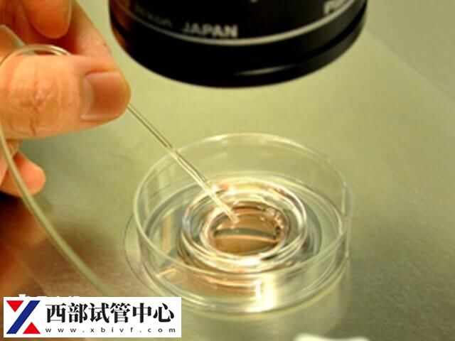 平衡易位三代试管经验是什么