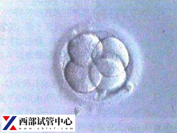 平衡易位是不是不遗传女(图2) 平衡易位会遗传给后代