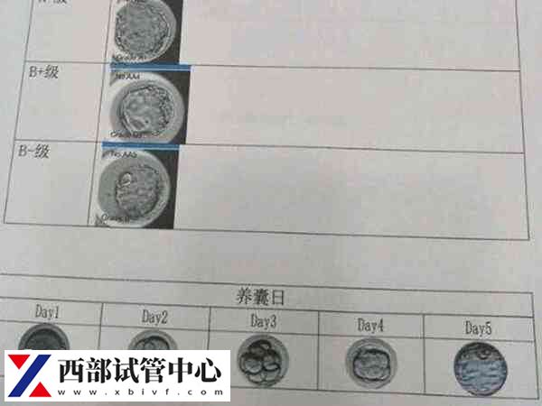 囊胚移植标准有哪些
