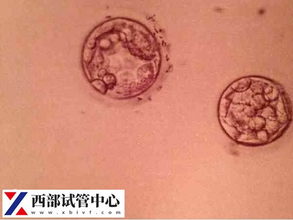 3cb囊胚成功率多高